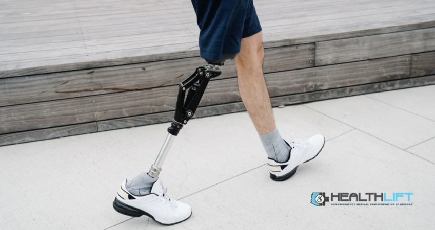Amputee Transport in Arizona: Safe Travel to Prosthetic and Rehabilitation Clinics
